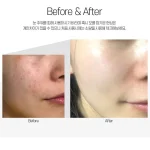 مزو کرم تسکیندهنده و ترمیمکننده سنتلا مدی پیل - تصویر 4